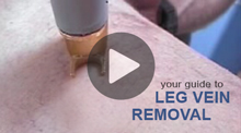 Video: Your Guide to Leg Vein